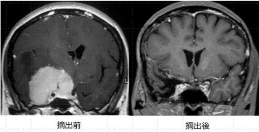 脳ドッグのガイドライン